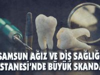Samsun Ağız Ve Diş Sağlığı Hastanesi’nde Büyük Skandal!