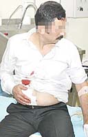 Öğretmene bıçağa 5 yıl