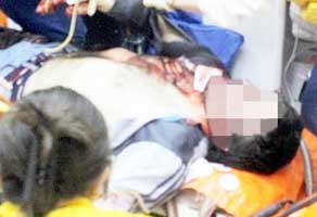 İki kardeşi vurdu 21 yıl ceza aldı
