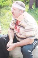 Samsun'da Tramvay Kazası