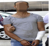 Harçlık Vermeyen Annesinin Yüzünü Kesti