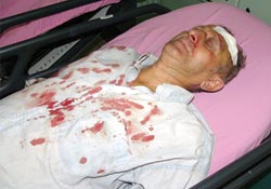 Mobilet yayaya çarptı