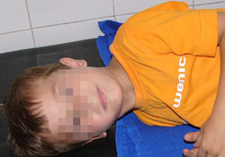 Kulağını kene ısırdı