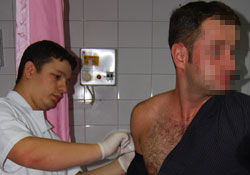 Piknikçiyi kene ısırdı