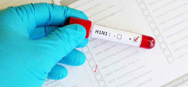 H1N1’den 1 Kişi Öldü