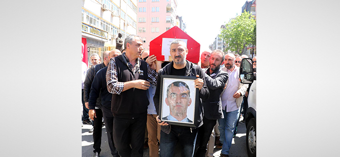 Diş Çekiminden Sonra Hayatını Kaybetti