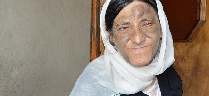 HASTANEYE GÖTÜRÜLMEDİ