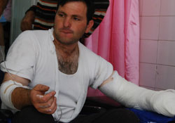 Parmaklarını makinaya kaptırdı