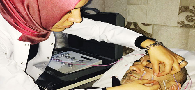 YÜZ FELCİNDE AKUPUNKTUR BAŞARISI