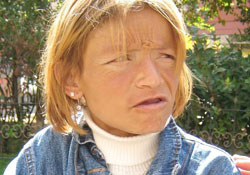 Hastalıklar peşini bırakmıyor