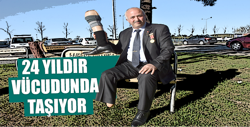 Şarapnel parçalarını 24 yıldır vücudunda taşıyor