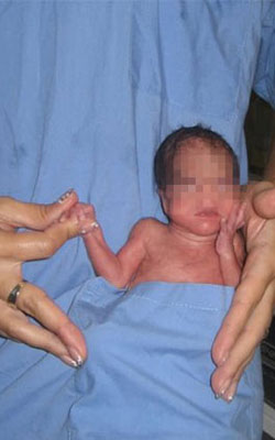 Hemşirenin şok fotoğrafı ...