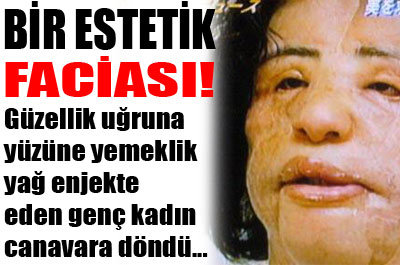 Yüzüne yemeklik yağ enjekte etti ...