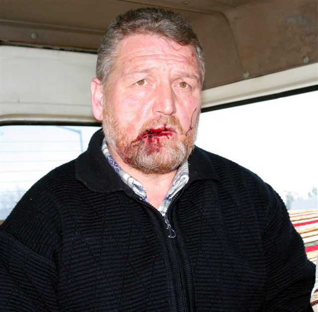 ÖMÜ'de türban kavgası