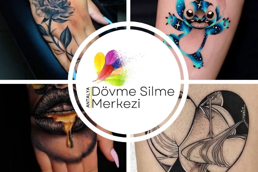 Antalya Dövme Silme Merkezi İle Sorunsuz İşlem