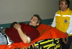 Sağ bacağa enişte kurşunu