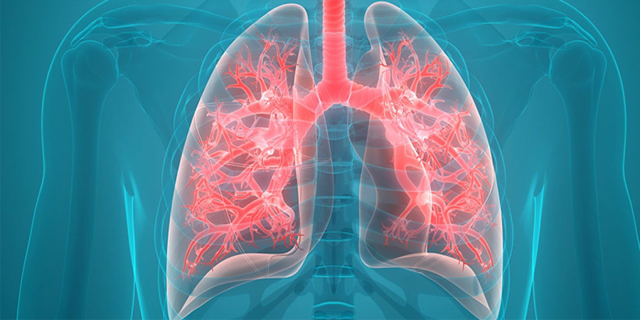 KOAH Balon Tedavisi Nedir?