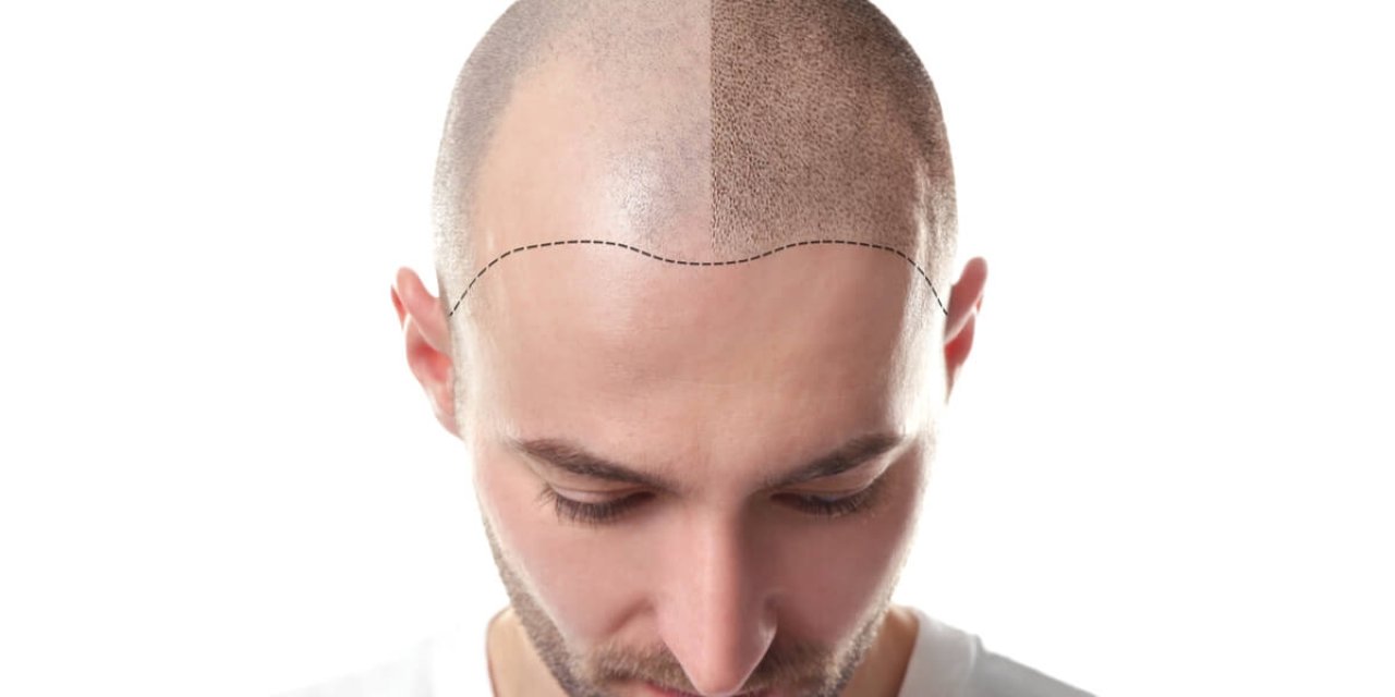 En İyi 10 Saç Ekimi Kliniği (2026 Rehberi)