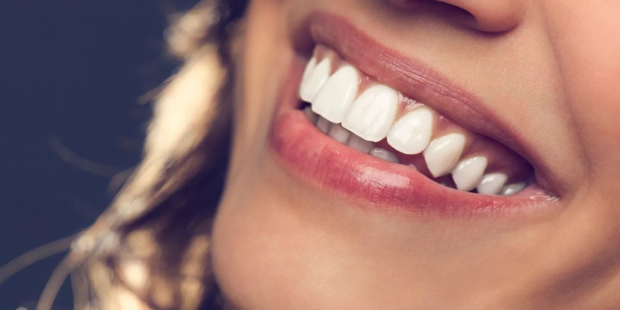 Hollywood Smile Nedir?