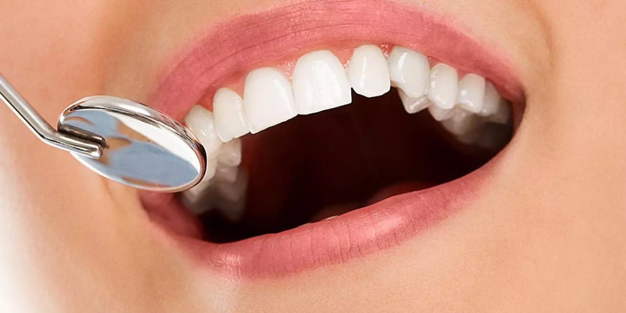 Zirkonyum Kaplama Nedir?