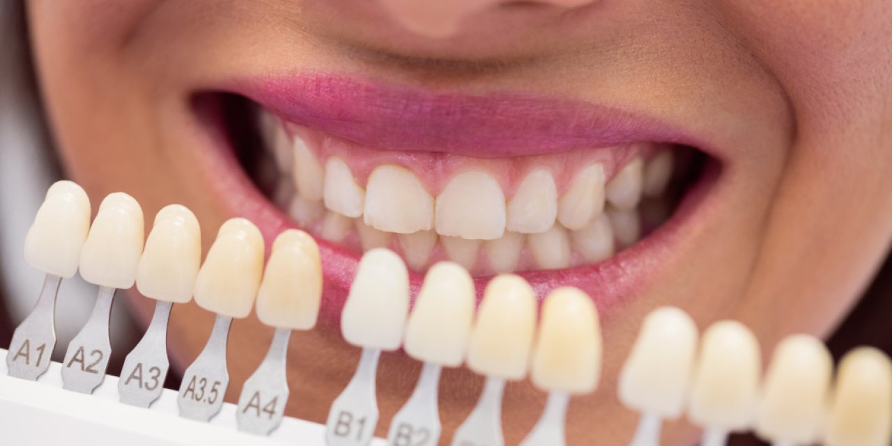 Antalya’da Ortodonti ve Cerrahi Uygulamalara İlgi Artıyor: Diş Teli Tedavisi ve 20’lik Diş Çekimi Gündemde