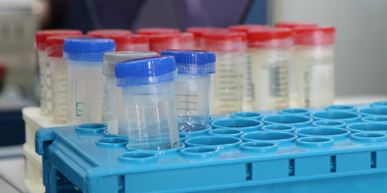 Antarktika’dan alınan mikroorganizmaları tarıma kazandırılacak