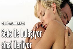 Genital Herpes: Seks ile bulaşıyor, sinsi ilerliyor