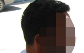 Polisin kolunu ısıran şahıslar serbest kaldı