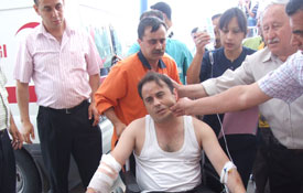 Trafik kazası; 17 yaralı