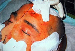 Adem'i işkence ederek öldürmüşler