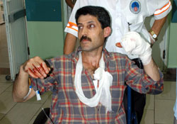 Parmaklarını hızara kaptırdı