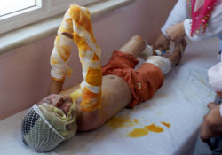 Oynarken yangın çıkardı