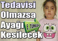 Tedavisi Olmazsa Ayağı Kesilecek