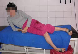 Zihinsel engelli kıza bıçaklı saldırı