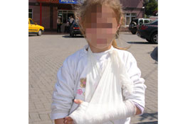 Kolu merndaneye sıkıştı