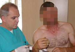 Koluna demir saplandı