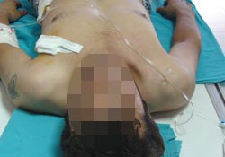 Bıçaklı saldırıda yaralandı