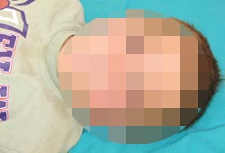 Gözünün içini kene ısırdı