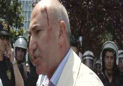 CHP'li vekilin kafası yarıldı