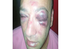 Polis dövdü iddiası