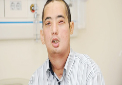 Yüz nakli yapılan Çolak basın karşısına çıktı