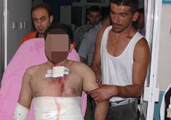 Fabrikada patlama: 1 yaralı