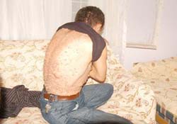 Onun hastalığına teşhis konulamıyor!