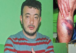 Polisin orantısız gücü komalık etti
