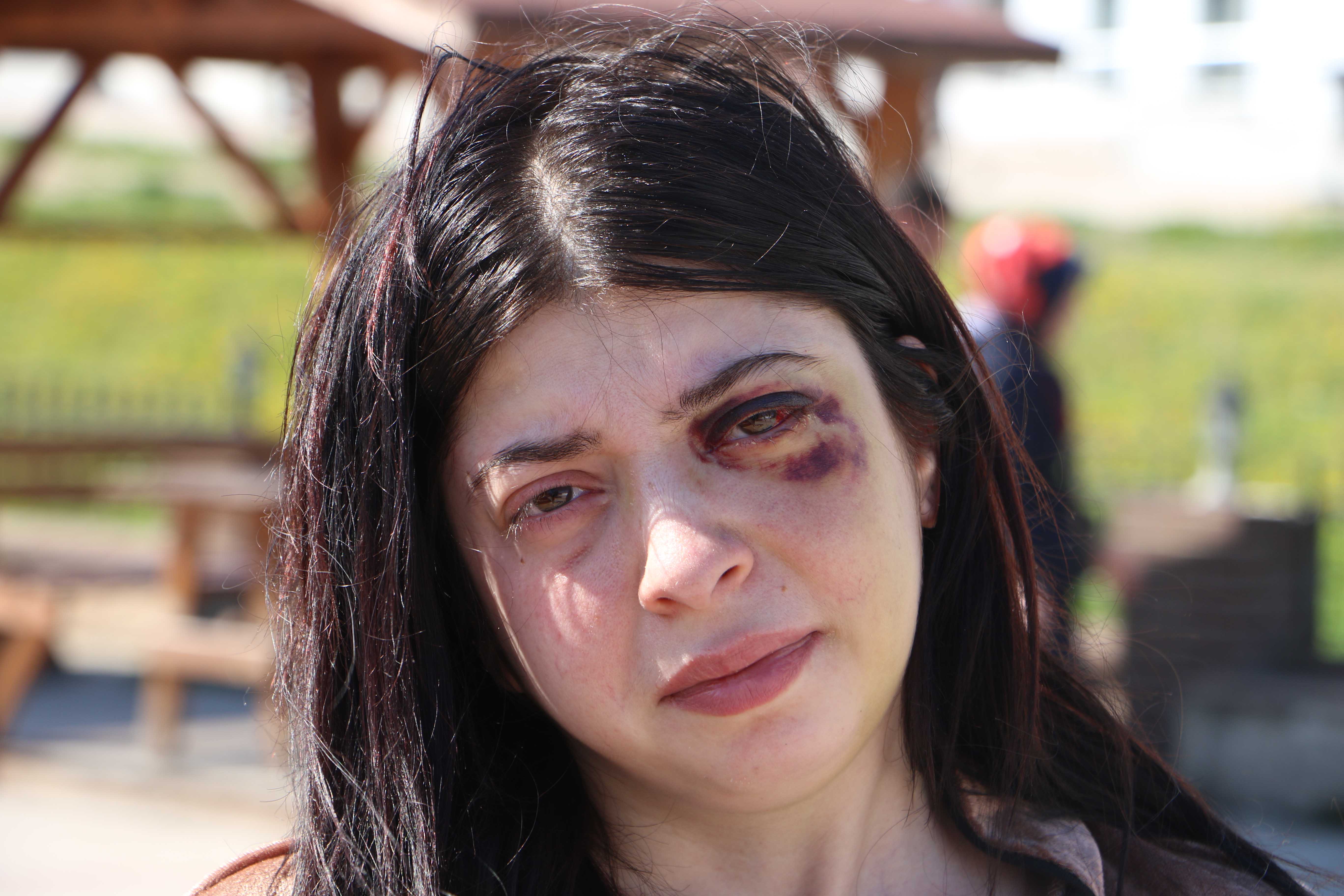 sokak-ortasinda-darbedilen-damla-platin-708053-209480.jpg